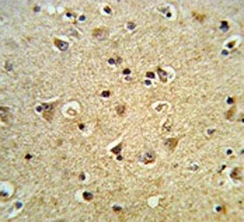 IHC testing of FFPE human brain tissue with PPIase D antibody. HIER: steam section in pH6 citrate buffer for 20 min and allow to cool prior to staining.