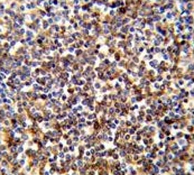 IHC testing of FFPE human spleen tissue with COTL1 antibody. HIER: steam section in pH6 citrate buffer for 20 min and allow to cool prior to staining.