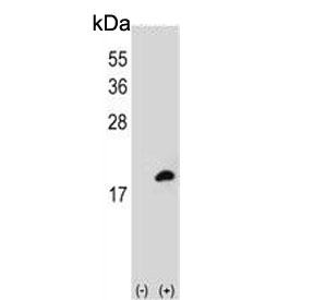 Western blot testing of 1) non-transfected and 2) transfected 293 cell lysate with COTL1 antibody.
