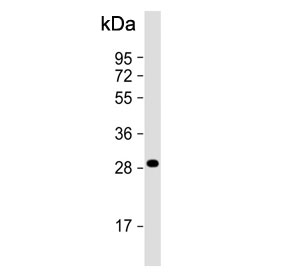 Western blot testing of human liver tissue lysate with QDPR antibody. Predicted molecular weight ~26 kDa.