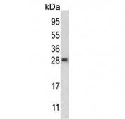 Western blot testing of mouse liver tissue lysate with QDPR antibody. Predicted molecular weight ~26 kDa.