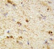 IHC testing of FFPE human brain tissue with QDPR antibody. HIER: steam section in pH6 citrate buffer for 20 min and allow to cool prior to staining.