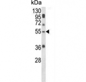 Western blot testing of mouse lung tissue lysate with SELENBP1 antibody. Predicted molecular weight ~52 kDa.
