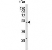 Western blot testing of human HL60 cell lysate with SELENBP1 antibody. Predicted molecular weight ~52 kDa.