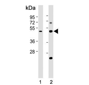 Western blot testing of 1) human kidney and 2) mouse kidney tissue lysate with Galactosylceramide sulfotransferase antibody. Predicted molecular weight ~49 kDa.