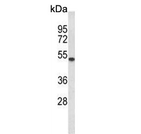 Western blot testing of mouse cerebellum tissue lysate with Galactosylceramide sulfotransferase antibody. Predicted molecular weight ~49 kDa.