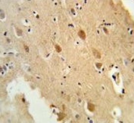 IHC testing of FFPE human brain tissue with Galactosylceramide sulfotransferase antibody. HIER: steam section in pH6 citrate buffer for 20 min and allow to cool prior to staining.