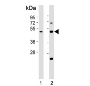 Western blot testing of 1) human kidney and 2) mouse kidney tissue lysate with Galactosylceramide sulfotransferase antibody. Predicted molecular weight ~49 kDa.