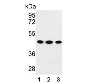 Western blot testing of human 1) K562, 2) HEK293 and 3) MDA-MB-231 cell lysate with GPA33 antibody. Expected molecular weight: 33-43 kDa depending on glycosylation level.