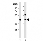 Western blot testing of human 1) 293T and 2) HT-29 cell lysate with GPA33 antibody. Expected molecular weight: 33-43 kDa depending on glycosylation level.