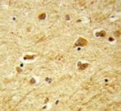 IHC testing of FFPE human brain tissue with ADAMTS18 antibody. HIER: steam section in pH6 citrate buffer for 20 min and allow to cool prior to staining.