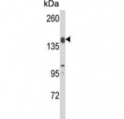 Western blot testing of mouse liver tissue lysate with ADAMTS18 antibody. Predicted molecular weight ~135 kDa.