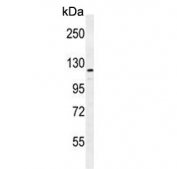 Western blot testing of human MDA-MB-231 cell lysate with ADAMTS18 antibody. Predicted molecular weight ~135 kDa.