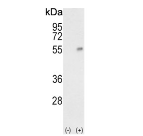 Western blot testing of 1) non-transfected and 2) transfected 293 cell lysate with Haptoglobin antibody.