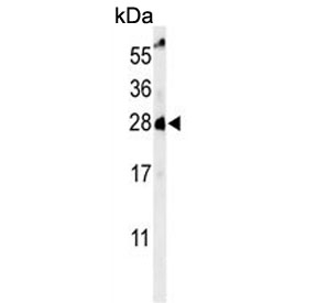 Western blot testing of human HeLa cell lysate with RAB8A antibody. Predicted molecular weight ~24 kDa.