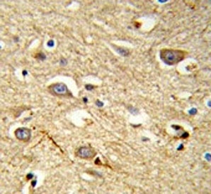 IHC testing of FFPE human brain tissue with RAB8A antibody. HIER: steam section in pH6 citrate buffer for 20 min and allow to cool prior to staining.