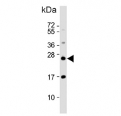 Western blot testing of human HCT-116 cell lysate with RAB8A antibody. Predicted molecular weight ~24 kDa.