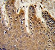 IHC testing of FFPE human skin tissue with Cdc37 antibody. HIER: steam section in pH6 citrate buffer for 20 min and allow to cool prior to staining.