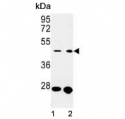 Western blot testing of human 1) MCF7 and 2) A2058 cell lysate with Cdc37 antibody. Expected molecular weight: 44-50 kDa.