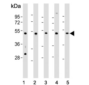 Western blot testing of 1) human A431, 2) rat C6, 3) human Jurkat, 4) human K562 and 5) human LNCaP cell lysate with Cdc37 antibody. Expected molecular weight: 44-50 kDa.