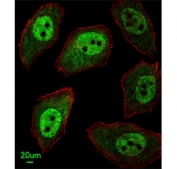 Immunofluorescent staining of human U-251 cells with APEX2 antibody (green) and anti-Actin (red).