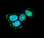 Immunofluorescent staining of human MCF7 cells with MAPK8IP1 antibody (green) and DAPI nuclear stain (blue).