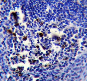 IHC testing of FFPE human tonsil tissue with POU2AF1 antibody. HIER: steam section in pH6 citrate buffer for 20 min and allow to cool prior to staining.