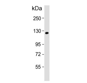 Western blot testing of human A431 cell lysate with KIF11 antibody Predicted molecular weight ~119 kDa.