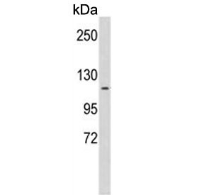 Western blot testing of (hamster) CHO cell lysate with KIF11 antibody Predicted molecular weight ~119 kDa.
