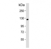 Western blot testing of human A431 cell lysate with KIF11 antibody Predicted molecular weight ~119 kDa.