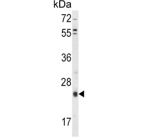 Western blot testing of human HepG2 cell lysate with TIMP3 antibody. Expected molecular weight: 24-33 kDa depending on glycosylation level.