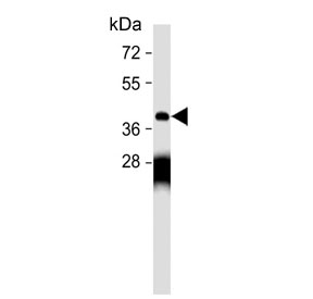Western blot testing of human MDA-MB-231 cell lysate with Mu-type Opioid Receptor antibody. Predicted molecular weight ~45 kDa.