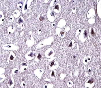 IHC testing of FFPE human brain tissue with Mu-type Opioid Receptor antibody. HIER: steam section in pH6 citrate buffer for 20 min and allow to cool prior to staining.