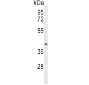 Western blot testing of mouse heart tissue lysate with Mu-type Opioid Receptor antibody. Predicted molecular weight ~45 kDa.