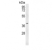 Western blot testing of human Ramos cell lysate with PTGER3 antibody. Predicted molecular weight: 44-50 kDa.
