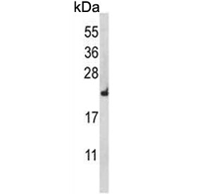 Western blot testing of human HEK293 cell lysate with RPL18A antibody. Predicted molecular weight ~21 kDa.