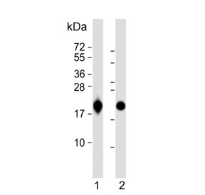 Western blot testing of human 1) HeLa and 2) MOLT4 cell lysate with RPL18A antibody. Predicted molecular weight ~21 kDa.