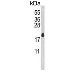 Western blot testing of mouse NIH 3T3 cell lysate with RPL18A antibody. Predicted molecular weight ~21 kDa.