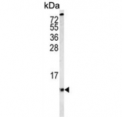 Western blot testing of human MDA-MB-435 cell lysate with COX6A1 antibody. Predicted molecular weight ~12 kDa.