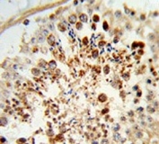 IHC testing of FFPE human testis tissue with COX6A1 antibody. HIER: steam section in pH6 citrate buffer for 20 min and allow to cool prior to staining.