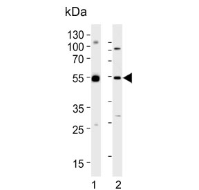 Western blot testing of human 1) U-251 MG and 2) PC-3 cell lysate with DEK antibody. Expected molecular weight: 43-50 kDa.
