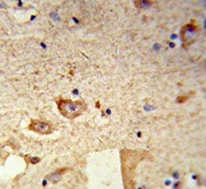 IHC testing of FFPE human brain tissue with Destrin antibody. HIER: steam section in pH6 citrate buffer for 20 min and allow to cool prior to staining.