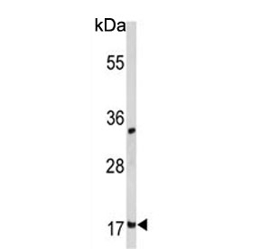 Western blot testing of human MCF7 cell lysate with Destrin antibody. Predicted molecular weight ~19 kDa.