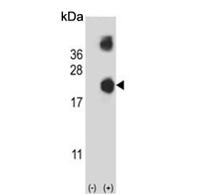 Western blot testing of 1) non-transfected and 2) transfected 293 cell lysate with Destrin antibody.
