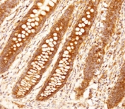 IHC testing of FFPE human appendix tissue with FCGR1B antibody. HIER: steam section in pH9 EDTA buffer for 20 min and allow to cool prior to staining.