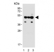 Western blot testing of human 1) HL60, 2) HeLa and 3) K562 cell lysate with FCGR1B antibody. Predicted molecular weight: 22-32 kDa but may be observed at higher molecular weights due to glycosylation.