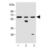 Western blot testing of human 1) CCRF-CEM, 2) ThP-1 and 3) HeLa cell lysate with FCGR1B antibody. Predicted molecular weight: 22-32 kDa but may be observed at higher molecular weights due to glycosylation.