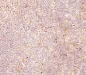 IHC testing of FFPE human tonsil tissue with FCGR1B antibody. HIER: steam section in pH9 EDTA buffer for 20 min and allow to cool prior to staining.