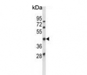 Western blot testing of human MCF7 cell lysate with Ataxin 3 antibody. Predicted molecular weight ~42 kDa.