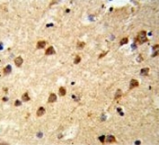 IHC testing of FFPE human brain tissue with Ataxin 3 antibody. HIER: steam section in pH6 citrate buffer for 20 min and allow to cool prior to staining.